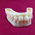 Impressão 3D na medicina dentária: precisão e personalização no tratamento dos pacientes